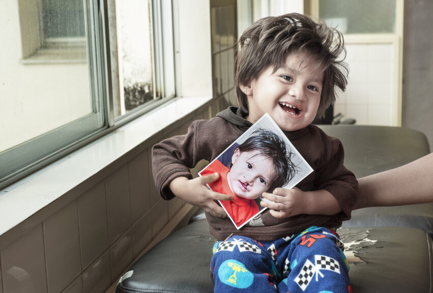 14 month old boy smiling as he holds his pre-cleft surgery photo