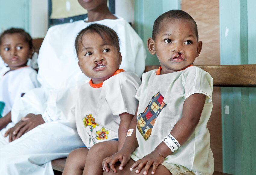 Elisa Havotrinhaina waiting to be called for surgery