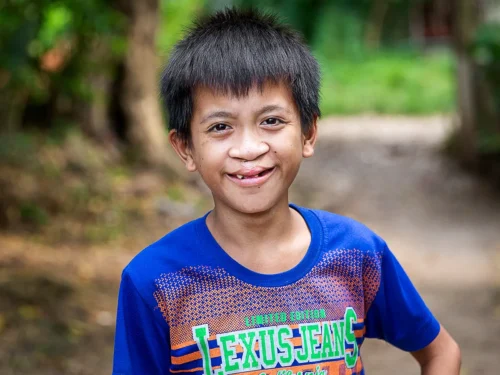 Joseph Misa - After Surgery - Philippines