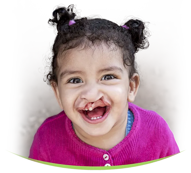 Basma Rafik from Morocco before Surgery