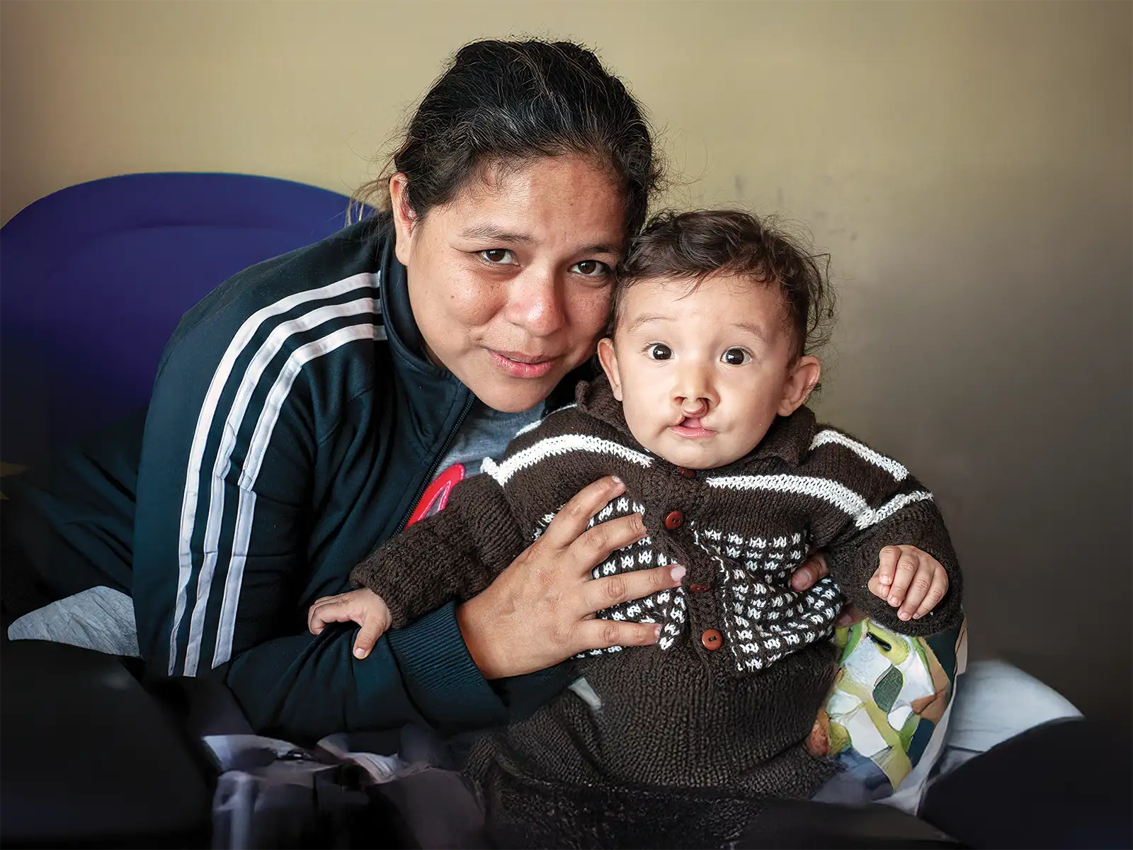 PER_2018_Lima_175_Andrews Santana Arias_Before Andrews Santana Arias - Before Surgery