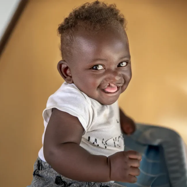 Young child smiling at the camera, his cleft lip visible