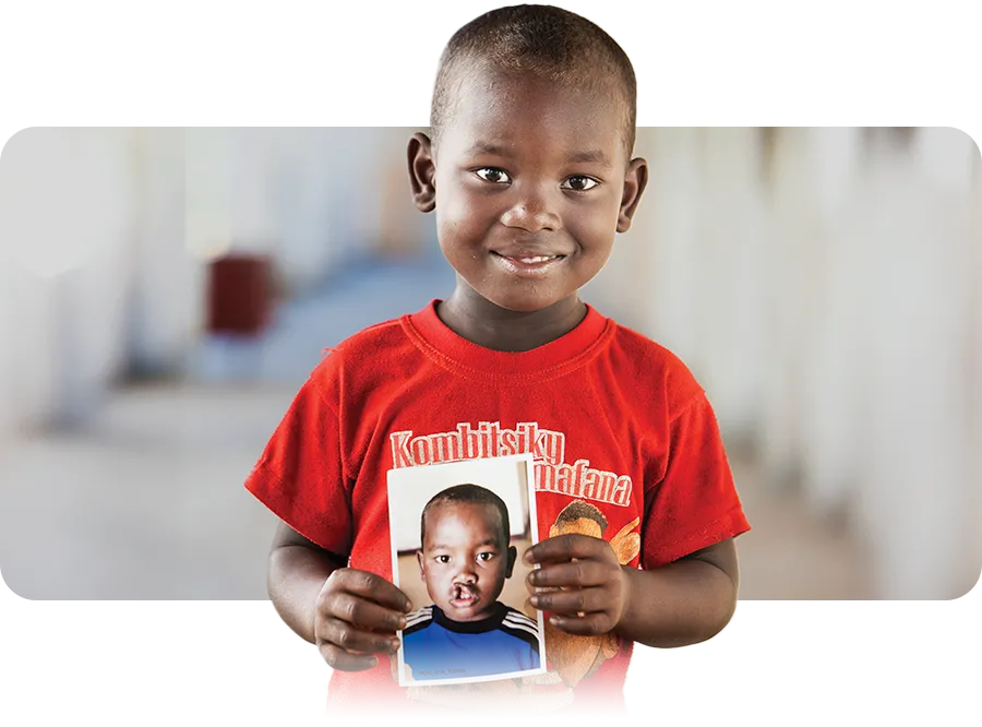 tommy-vavatenina-from-madagascar2 Tommy, age 4, from Madagascar